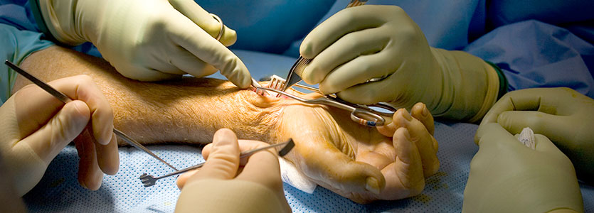 UF orthopaedic surgeons perform hand surgery at UF Health Jacksonville